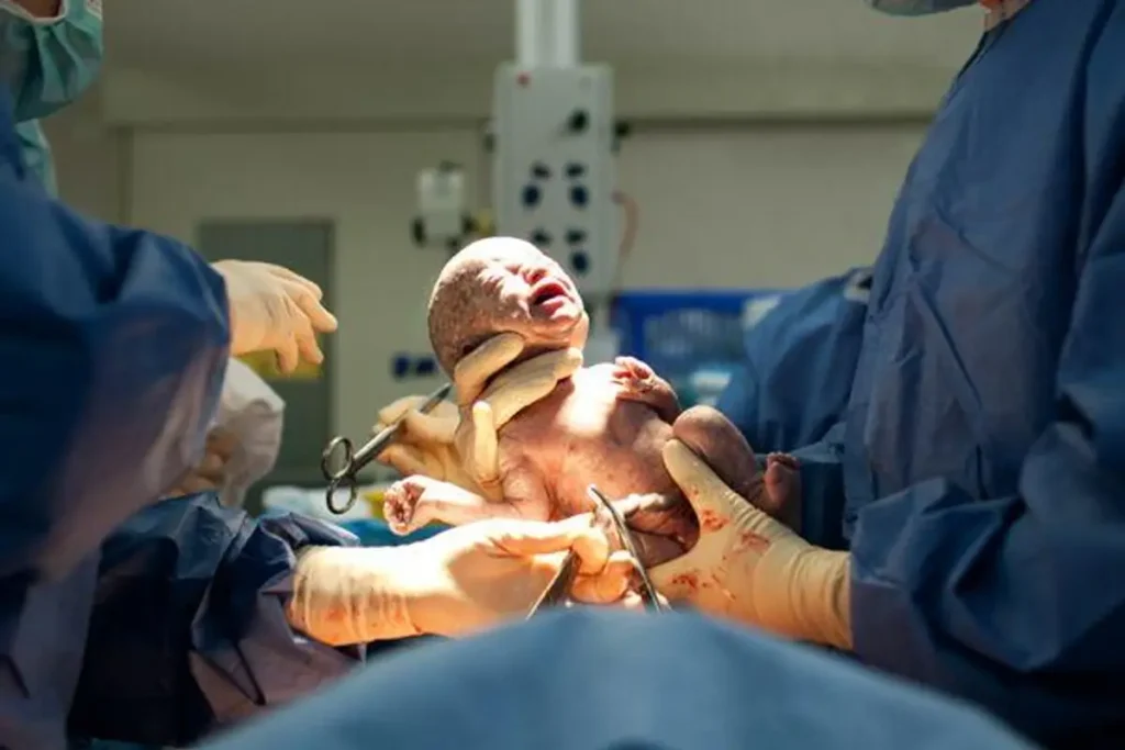 Newborn Delivery Care